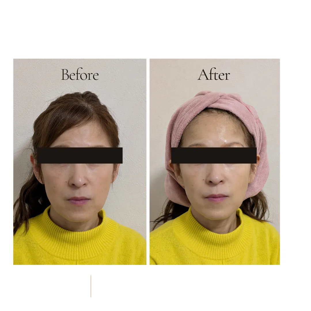 話題の韓国化粧品ルネセルで本気の肌改善